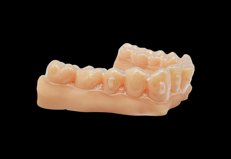 什么是3d打印正畸牙模？3d打印正畸牙模怎么做？